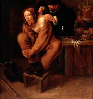 Visite libre de l'exposition "Le médecin face à la douleur, du 16e au 18e siècles"